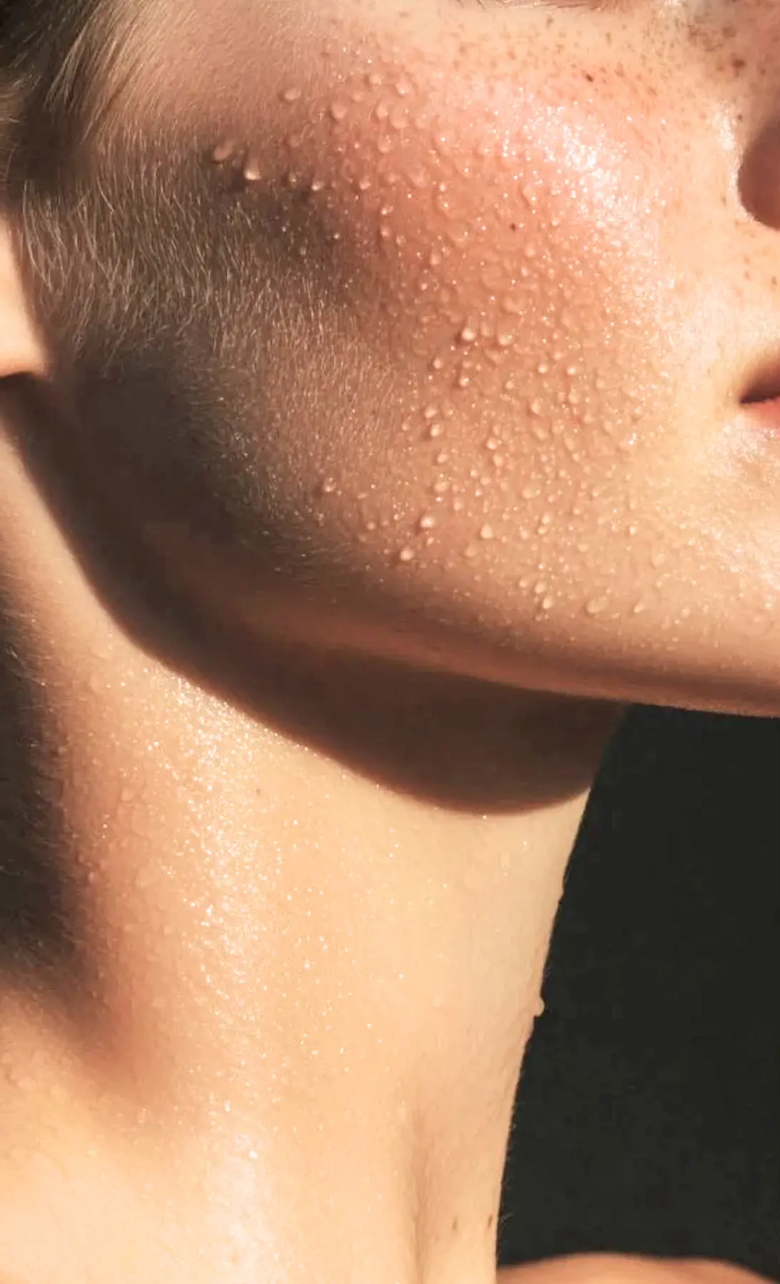 Sun-Stressed Skin